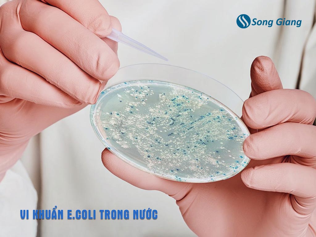 Vi khuẩn E.Coli trong nước